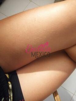 ARDIENTE Y DELICIOSA ESCORT LISTA PARA ATENDERTE